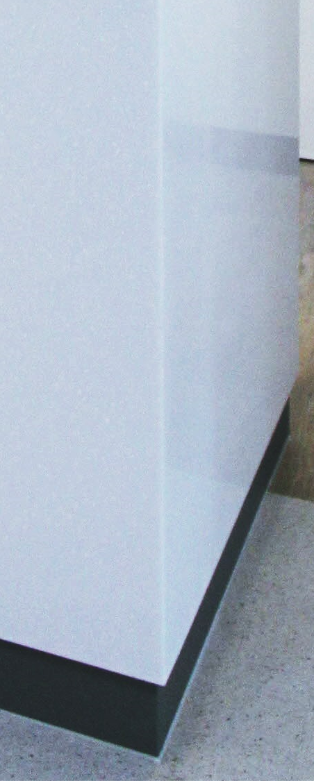 종로임플란트 이제는 걱정 말고 편안하게 관련 이미지 34