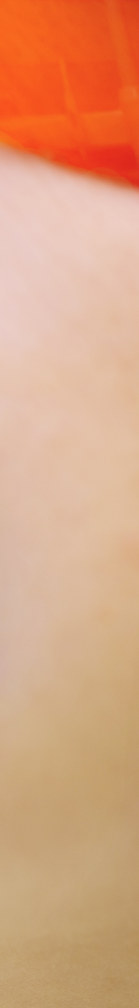 광화문역치과 치아미백과 라미네이트의 차이는? 관련 이미지 22