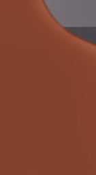 외국인치과에서 알려주는 치아미백 진실 관련 이미지 37