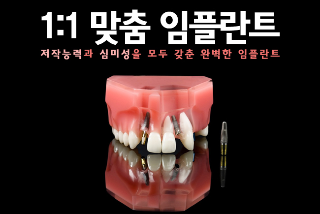 종각역 임플란트 믿고 맡기자! 관련 이미지 6