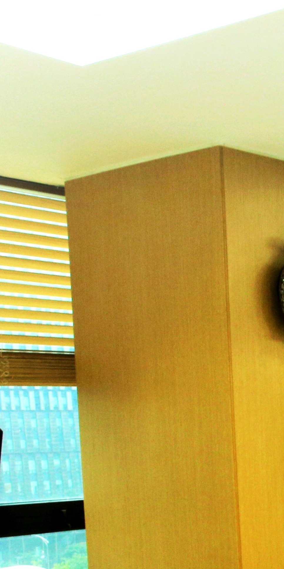 을지로입구역치과 이가 빠진 자리를 해결하려면? 관련 이미지 20