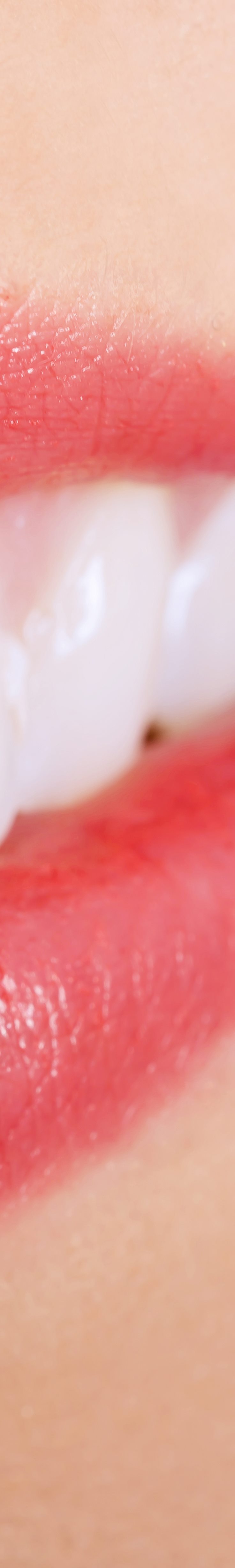 [종각역치과] 치아가 누렇게 보이는 진짜 이유, 미백 전에 꼭 알아야 할 것들 관련 이미지 16