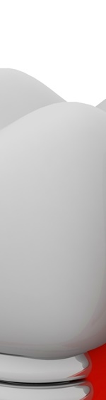 광화문치과 라미네이트 깨짐&middot;들뜸 원인과 예방 방법 완벽 정리 관련 이미지 10