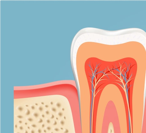 종로치과 충치가 생겼을 때 어떻게 치료 받아야 하나요? 관련 이미지 10