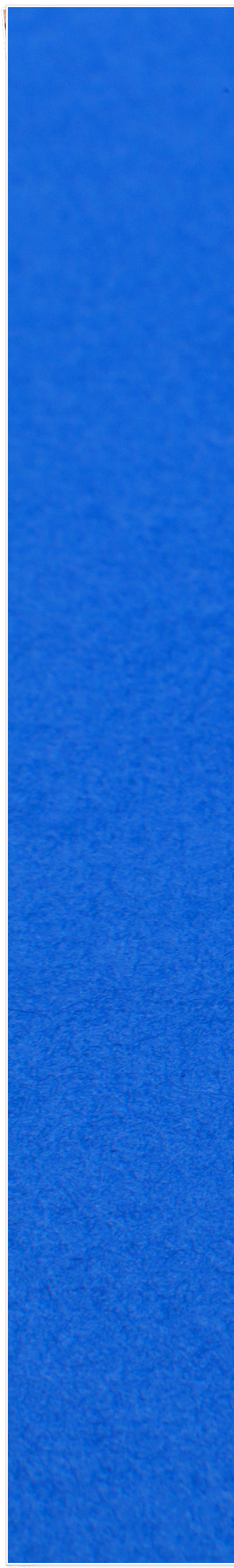 종로3가치과에서 알려드리는 무삭제 라미네이트 완벽 가이드 관련 이미지 20