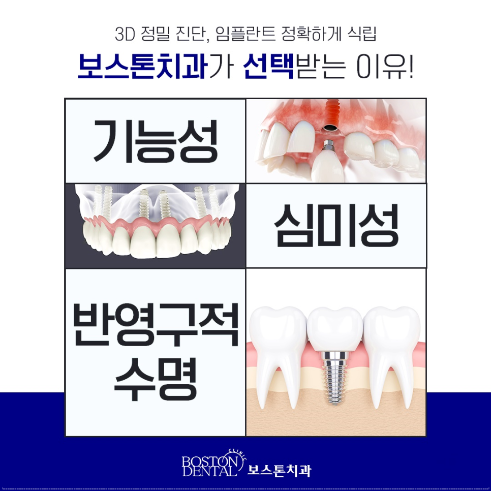 을지로입구역치과 오래 사용 가능한 임플란트 관련 이미지 6