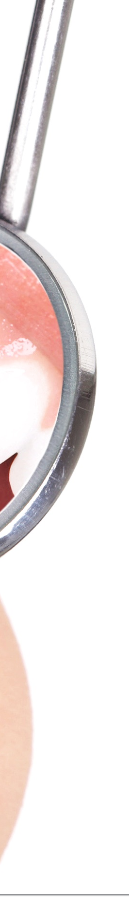 광화문역치과 라미네이트 치료가 궁금해요 관련 이미지 28