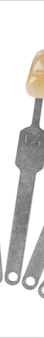 광화문치과 라미네이트 치료 전 고민해야 할 것 관련 이미지 8