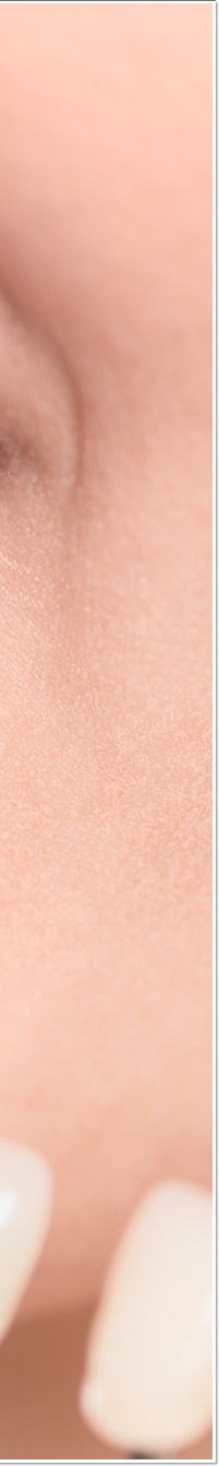 명동라미네이트, 단시간에 환한 미소를 가지고 싶다면? 관련 이미지 25