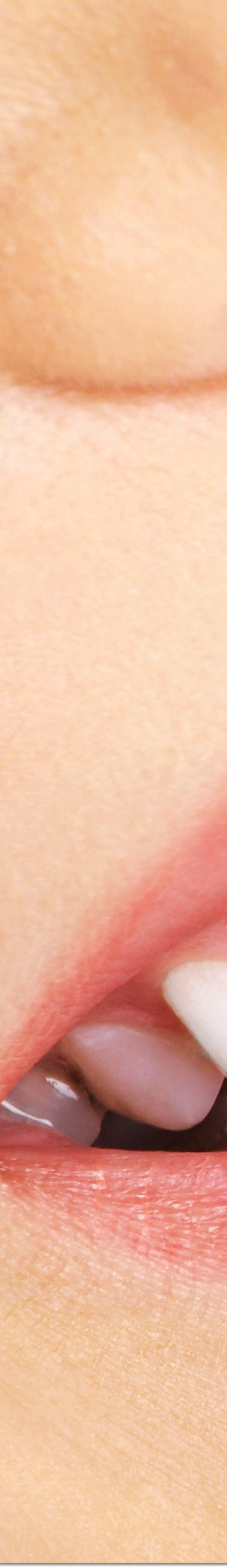 광화문역치과 라미네이트 치료가 궁금해요 관련 이미지 21