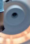 Jongno Dental Implants: Fast and Accurate Treatment Using Digital Technology image 12