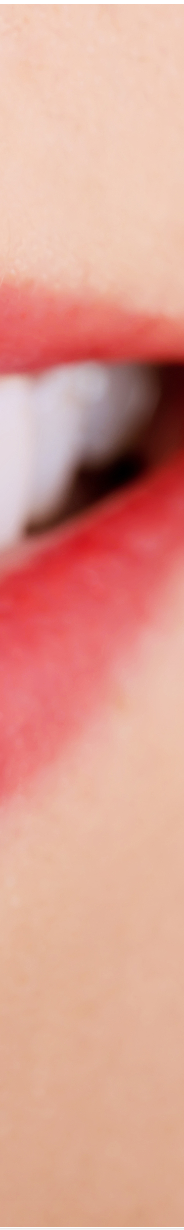 종로3가치과에서 알려드리는 무삭제 라미네이트 완벽 가이드 관련 이미지 18