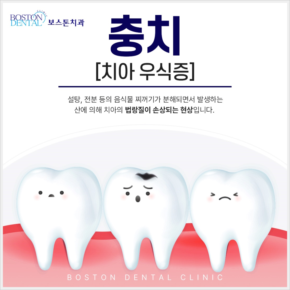 광화문역치과 이가 시리고 아프다면? 관련 이미지 1