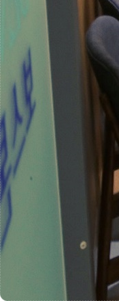 종로임플란트 이제는 걱정 말고 편안하게 관련 이미지 42