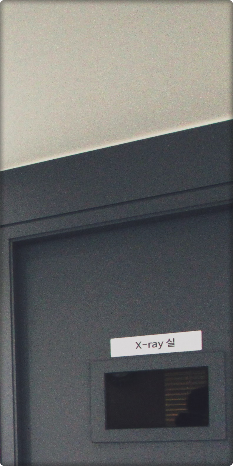 종각치과 빈 공간을 알맞게 해결합니다. 관련 이미지 17