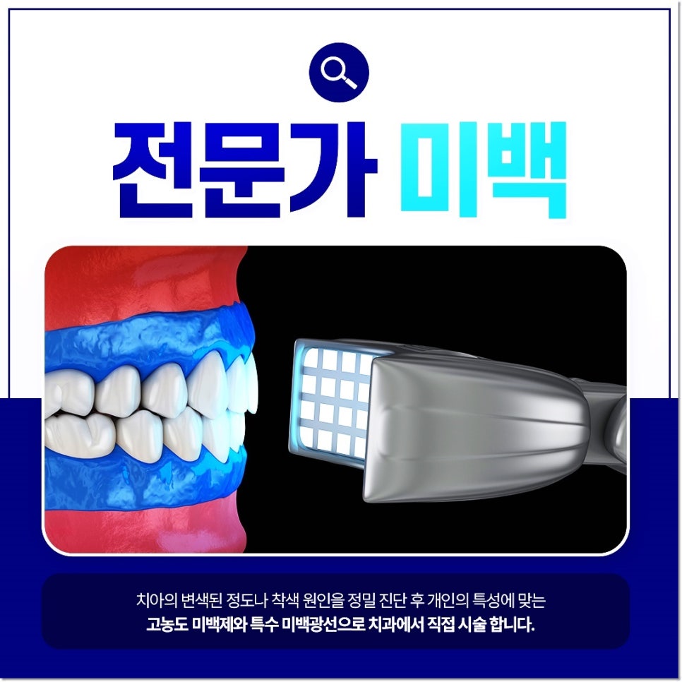 명동치과에서 알려드리는 치아미백, 전문가미백 차이점 관련 이미지 5