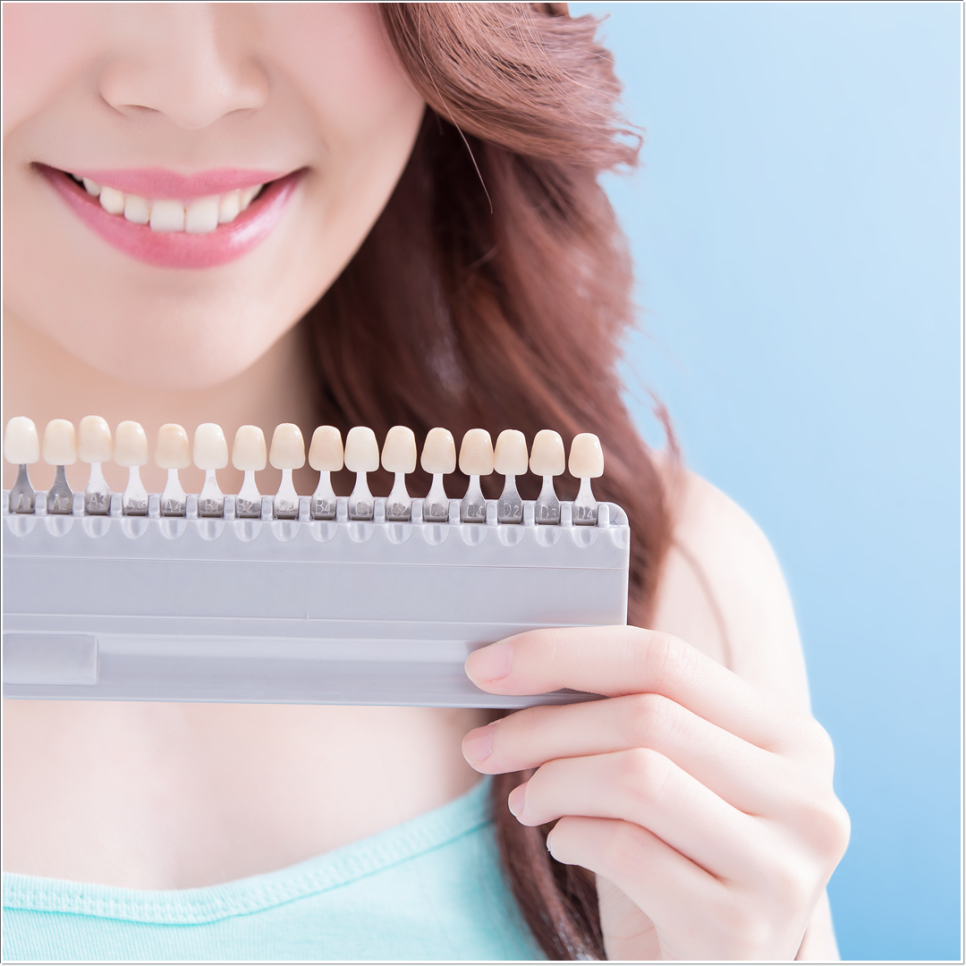 치아 변색 고민 끝, 을지로치과에서 듣는 라미네이트 사례 관련 이미지 18