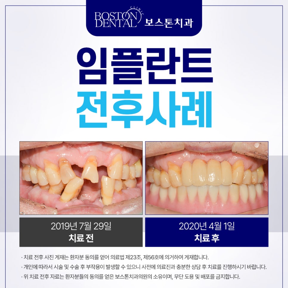 종로치과추천 이가 흔들려서 씹는게 불편해요 관련 이미지 2