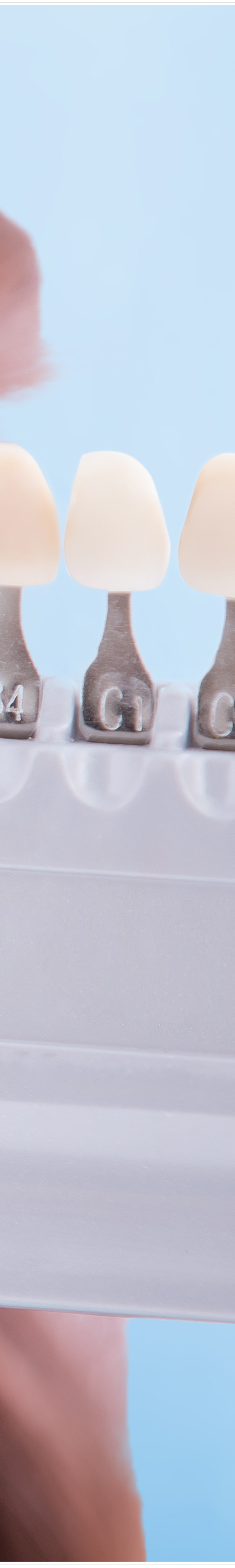 명동치과 라미네이트로 환하게 스마일~ 관련 이미지 17