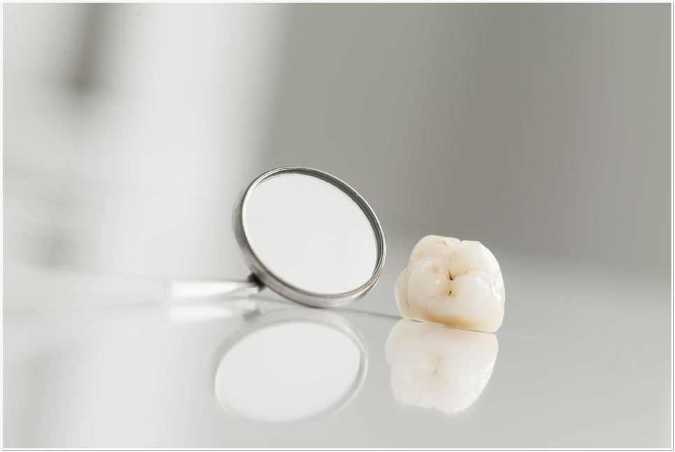 명동역치과 치아 미백, 궁금했던 모든 것 - 오해와 진실 관련 이미지 7