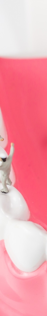 종각역치과 자연치아를 살리기 위한 대책, 신경치료 관련 이미지 21