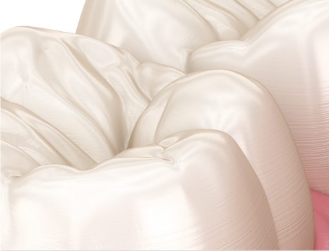 종로치과 충치가 생겼을 때 어떻게 치료 받아야 하나요? 관련 이미지 25