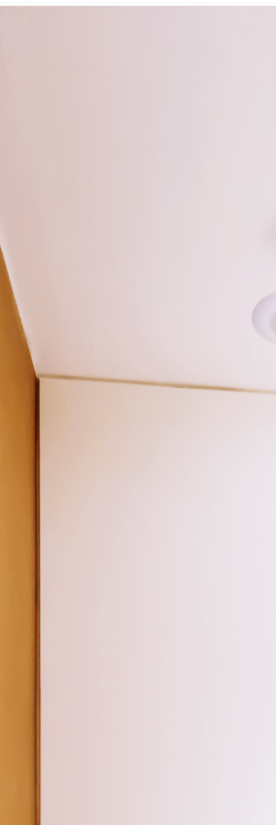 명동치과 저작력을 회복하기 위해서는? 관련 이미지 34