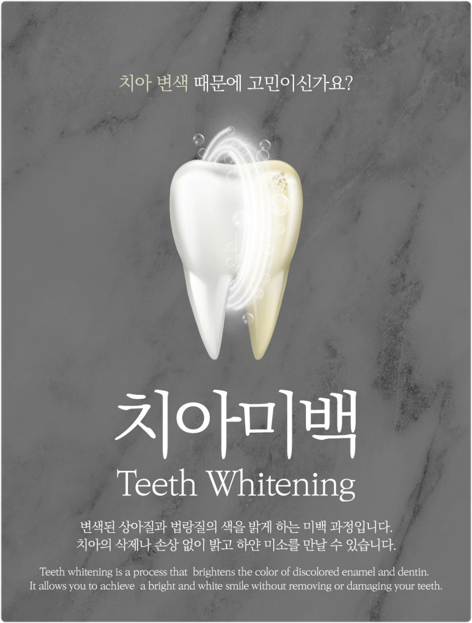 치아미백 부작용 없이 안전하게 하는 방법 | 광화문역치과 의료진 조언 관련 이미지 1