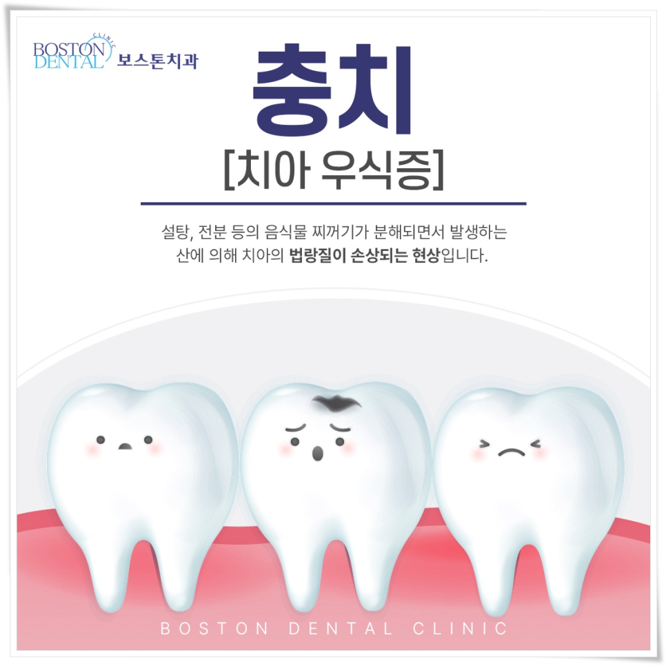 종로치과 수요일 8시까지 야간진료! 관련 이미지 2