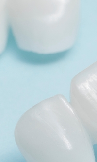 명동치과 라미네이트와 올세라믹의 차이점 관련 이미지 32