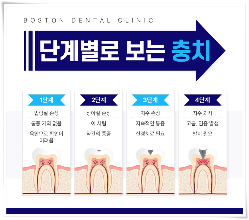 종각역 치과 점심시간에도 편하게 진료 보세요 관련 이미지 3