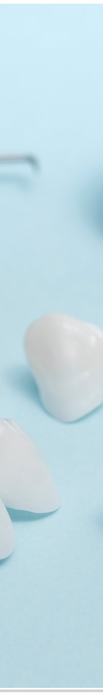 광화문역치과 치아미백과 라미네이트 나에게 필요한 건? 관련 이미지 39