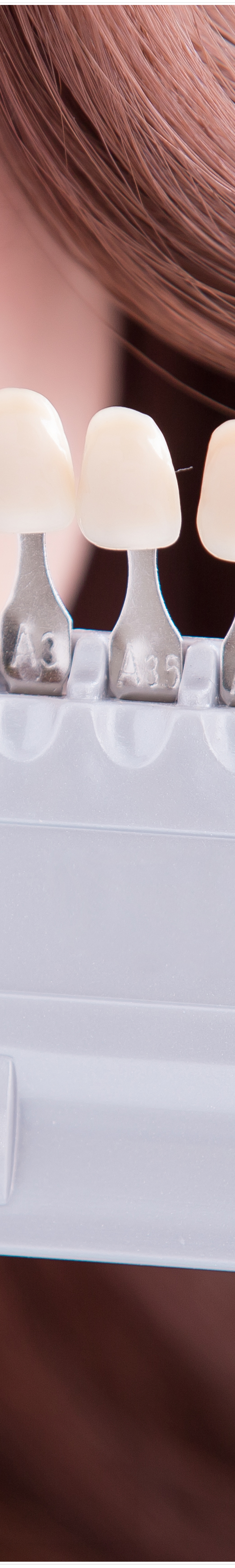 명동치과 라미네이트로 환하게 스마일~ 관련 이미지 14