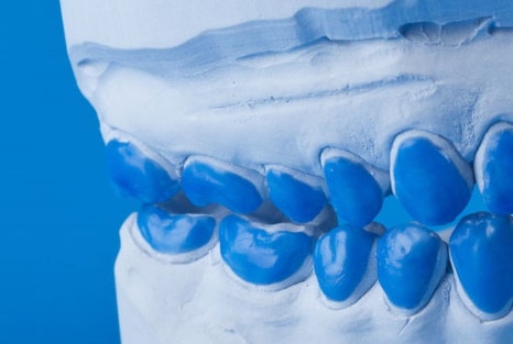 을지로치과 치아미백 후 관리 잘하고 계신가요? 관련 이미지 12