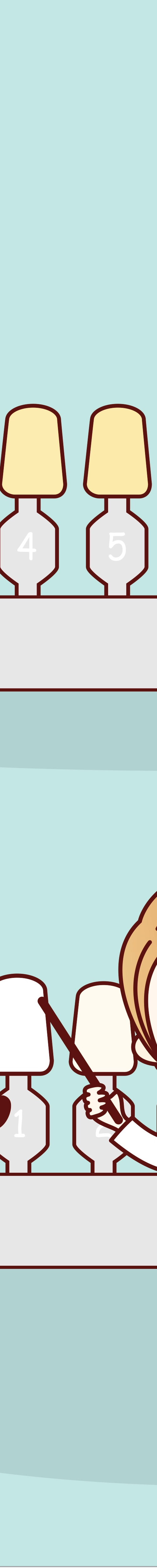 광화문역치과 라미네이트 치료가 궁금해요 관련 이미지 14