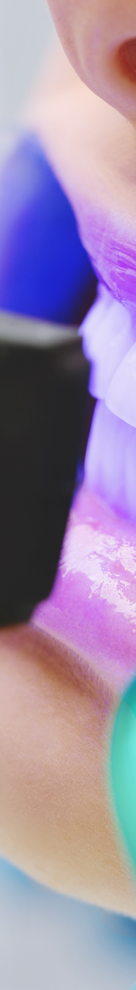 광화문역치과 치아미백과 라미네이트의 차이는? 관련 이미지 18