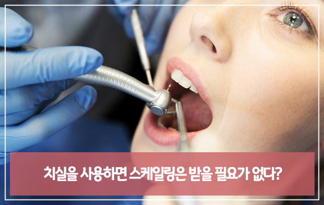 치실에 대한 잘못된 상식! 관련 이미지 4