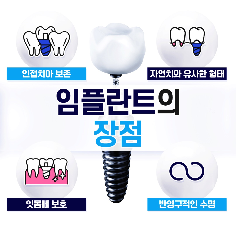종각역치과 임플란트 치료, 이것만은 알고 계세요! 관련 이미지 3
