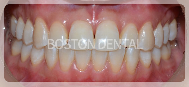 종로치아미백 환한 자신감! 관련 이미지 5