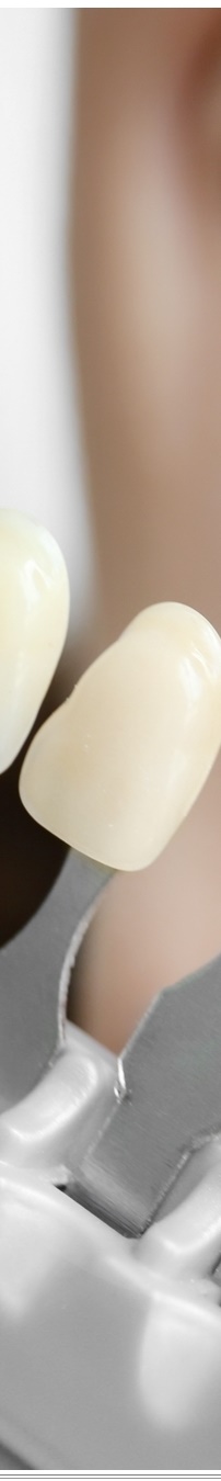 광화문역치과 생활습관에 따른 맞춤형 미백 관리 관련 이미지 28