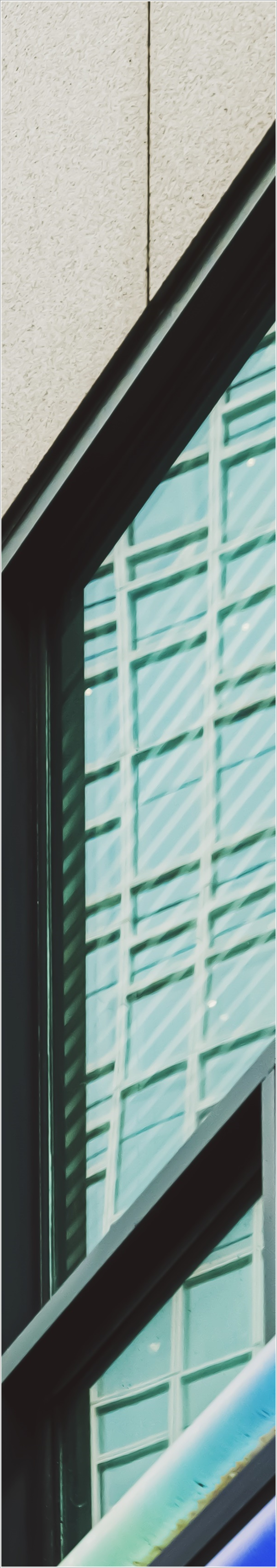 종각역 치과 상실된 치아 때문에 고민, 걱정이신가요? 관련 이미지 29