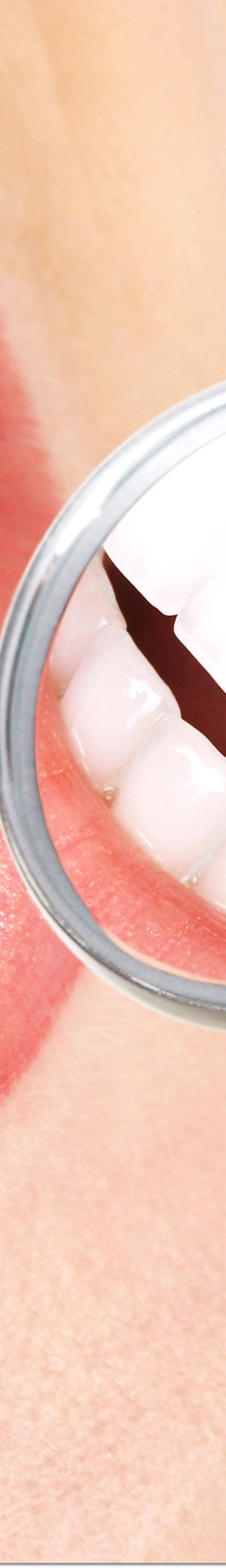 광화문역치과 라미네이트 치료가 궁금해요 관련 이미지 26