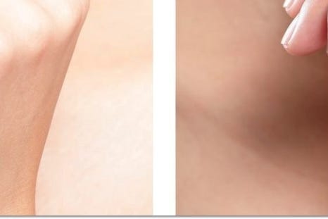 명동치과에서 알아보는 치아미백의 모든 것 관련 이미지 26