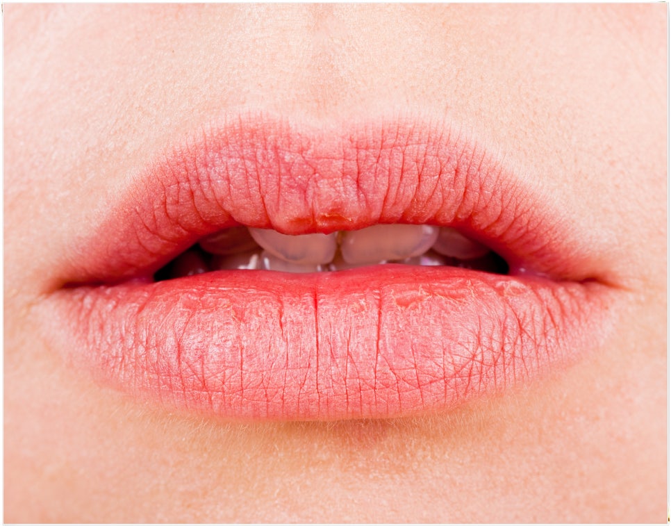 겨울철 구강 관리의 중요성에 대해 알려드립니다. 관련 이미지 1