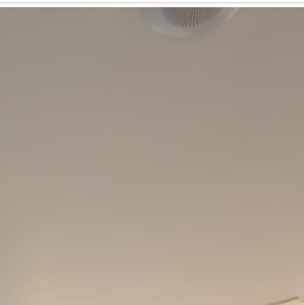 종각치과의 치아미백으로 하얀 미소 찾기 관련 이미지 16