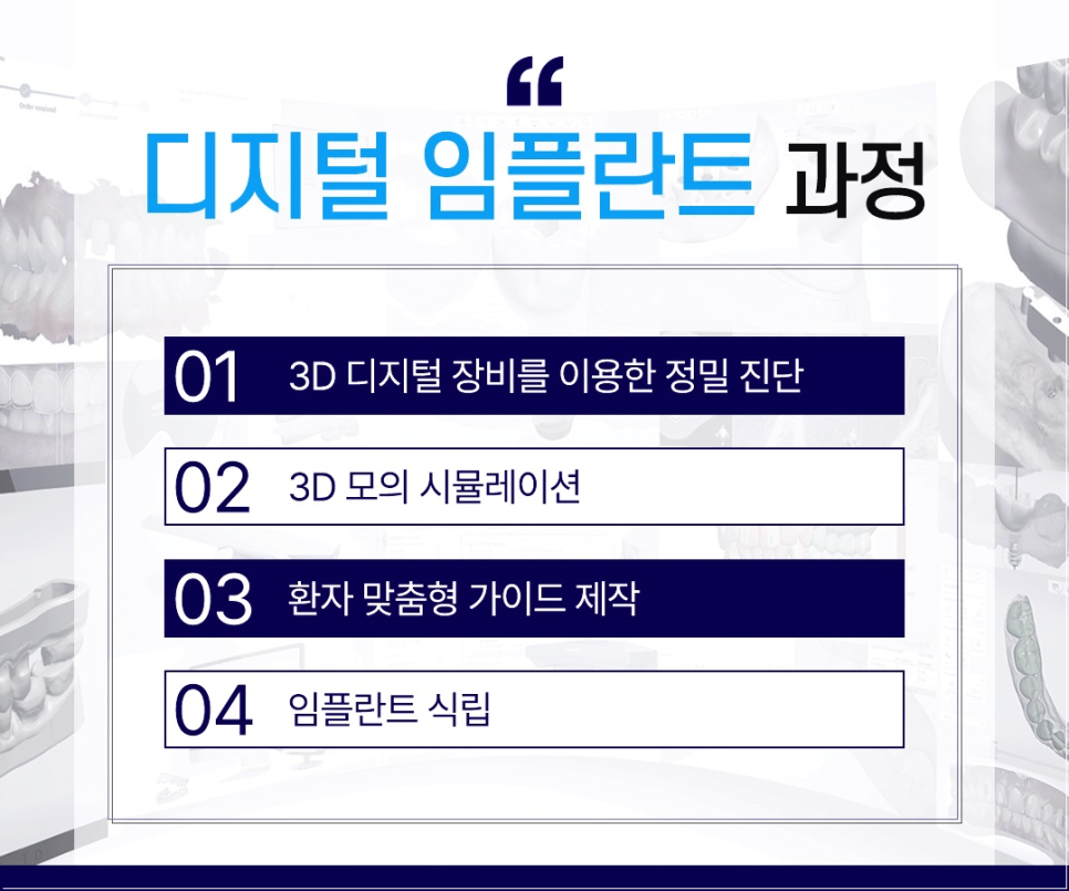 종로임플란트 건강한 치아를 위한 현명한 선택 관련 이미지 6