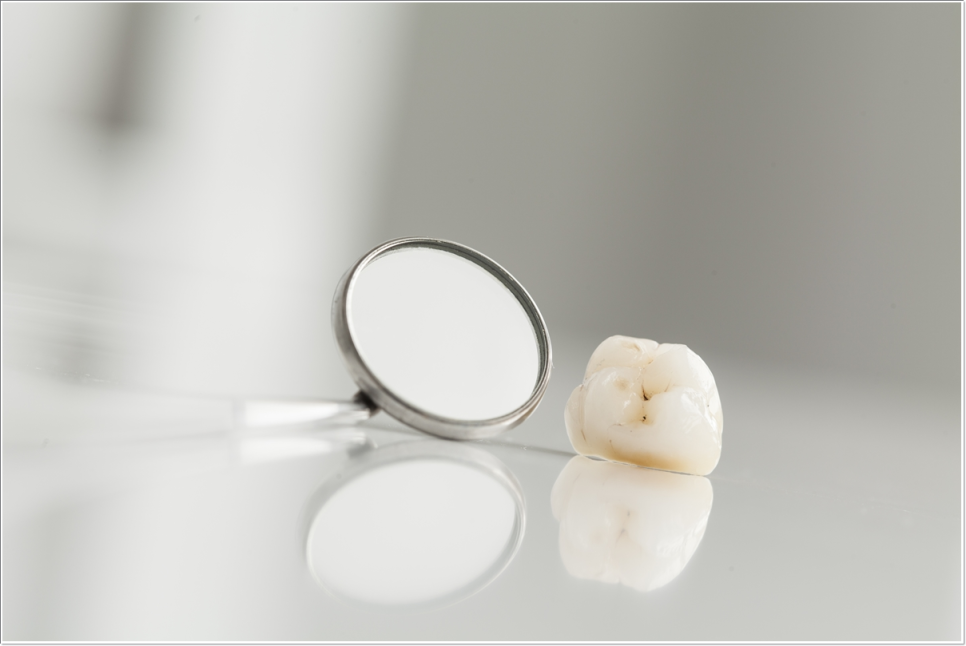 종로치과 치아미백 효과는 얼마나 지속될까? 관련 이미지 5