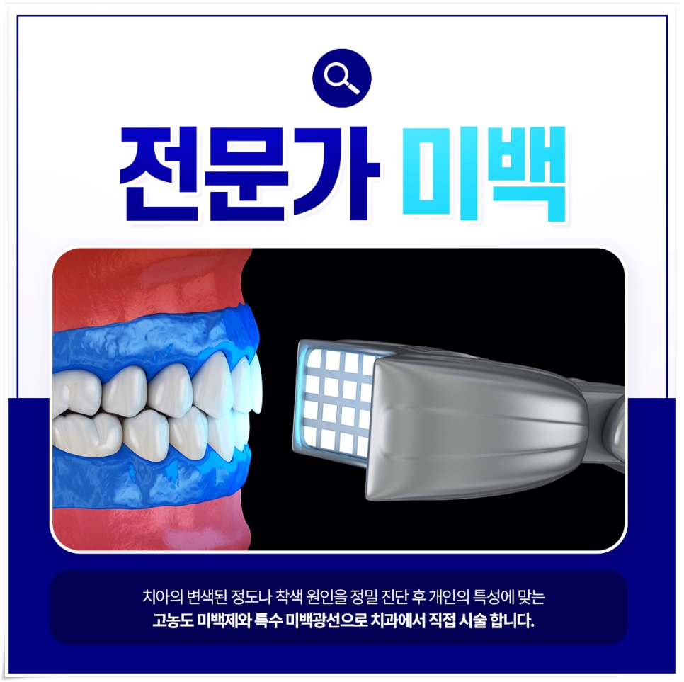 외국인치과에서 알려주는 치아미백 진실 관련 이미지 5