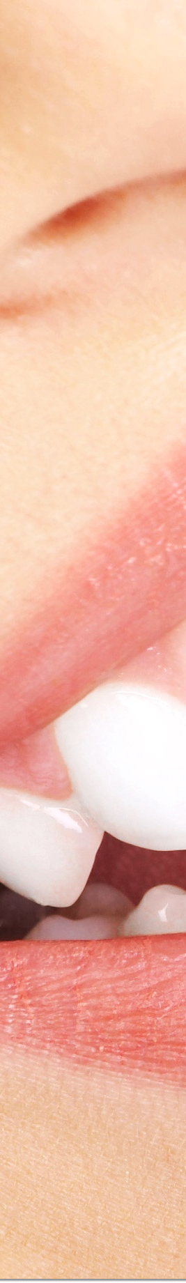 광화문역치과 라미네이트 치료가 궁금해요 관련 이미지 22