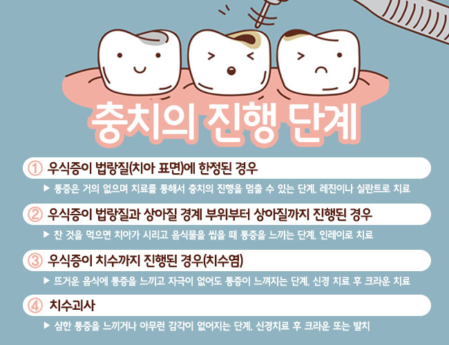 광화문치과추천 충치치료 편하게~ 관련 이미지 4